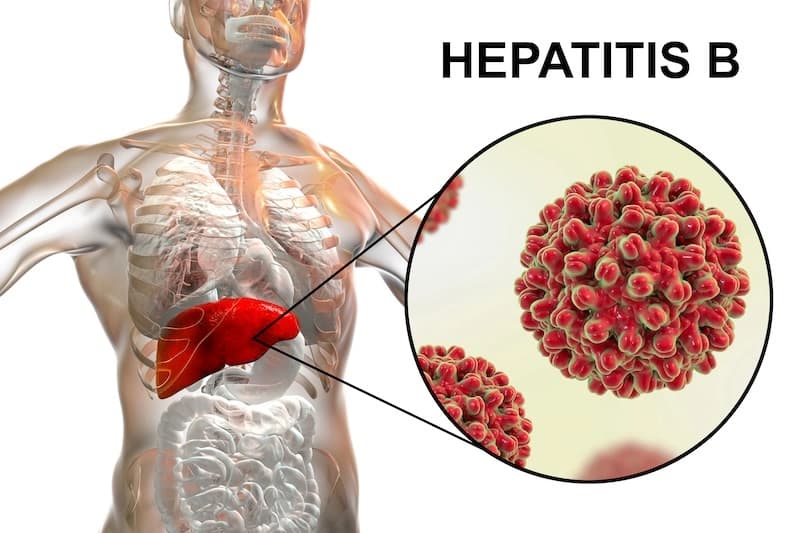 Hepatitis B: HBsAg, anti-HBs y anti-HBc explicados