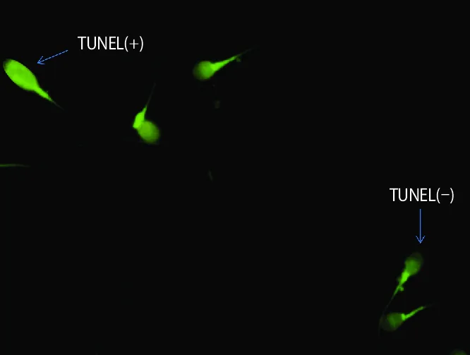 Test de TUNEL: fragmentación del ADN espermático