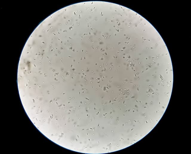 Espermograma: La Clave para Entender la Fertilidad Masculina