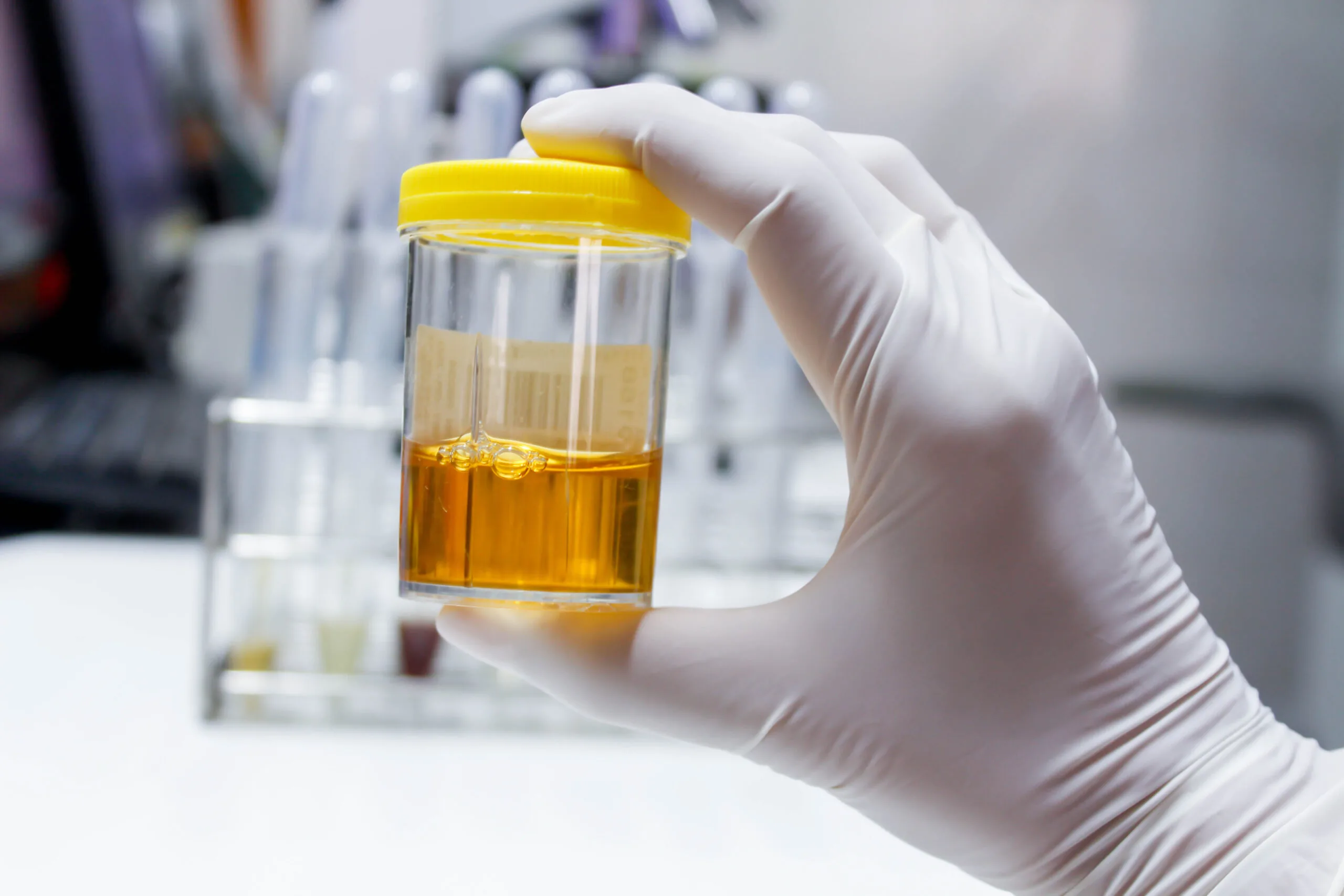 Detección de ITS por PCR (orina o hisopado) y PrEP