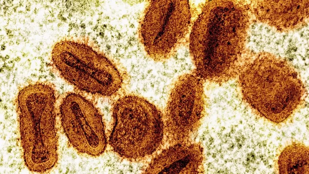Mpox (viruela símica): cómo se detecta por PCR