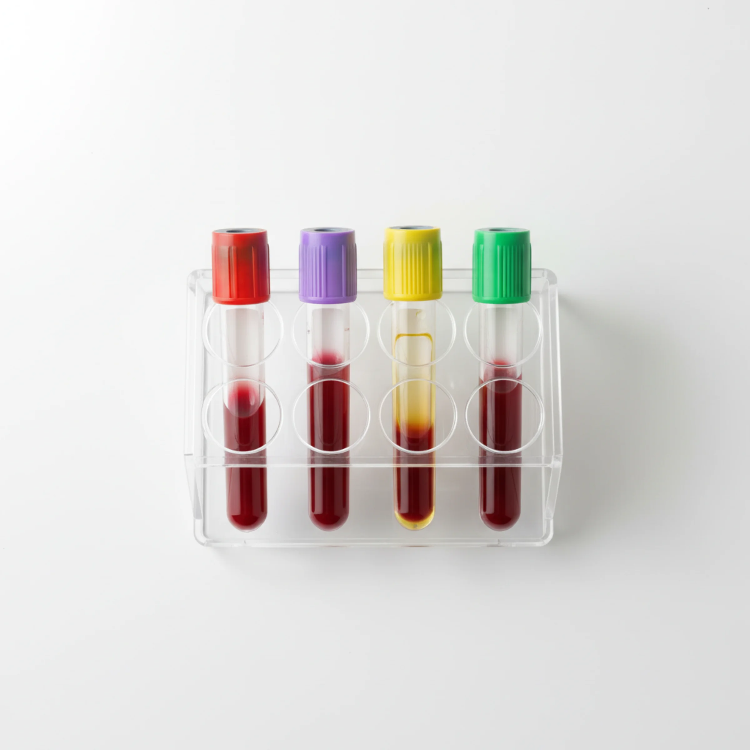 Chequeo ITS básico (HIV, Hepatitis B y C, sífilis): 4 tubos de extracción con tapas roja, violeta, amarilla y verde dispuestos en gradilla blanca.