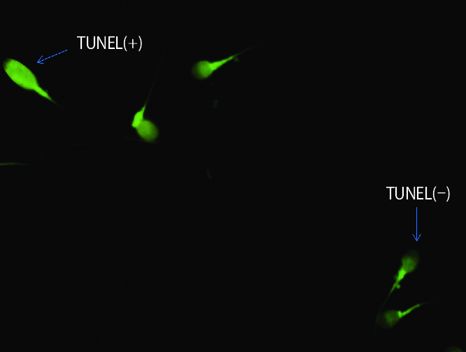 Tunel test Laboratorio Aclimu Técnica de Túnel Test en Laboratorio Aclimu para análisis de integridad del ADN espermático, clave en la evaluación de fertilidad masculina.