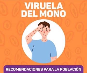 viruela del mono Buenos Aires test