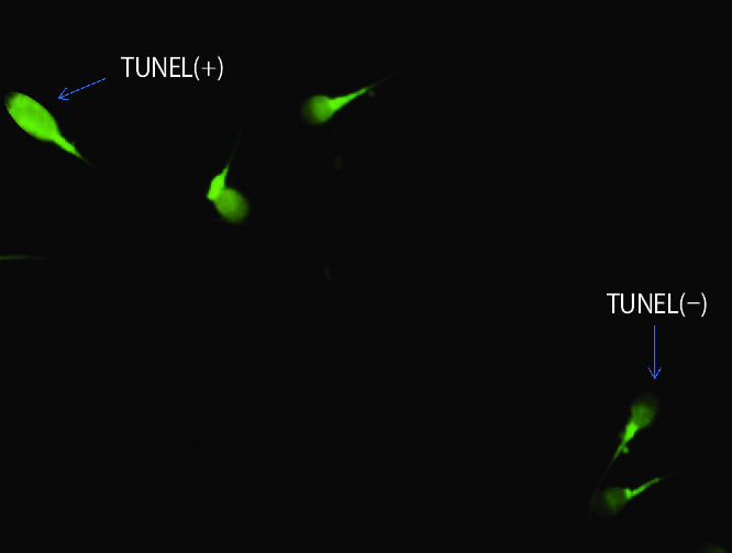 Técnica de Túnel Test en Laboratorio Aclimu para análisis de integridad del ADN espermático, clave en la evaluación de fertilidad masculina.