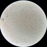 Espermatozoides observados al microscopio en el Laboratorio Aclimu